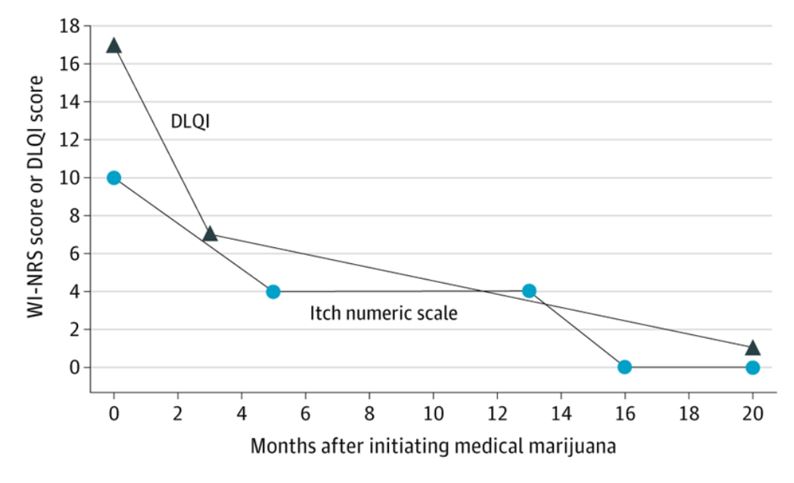 cannabis for pruritis